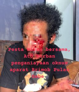 Polisi di Pulau Gebe Diduga Halangi Proses Visum Korban Penganiayaan